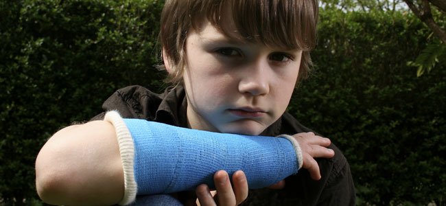 nino brazo roto p - Las fracturas que pueden ser señales de abuso infantil
